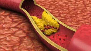 "Triglycerides