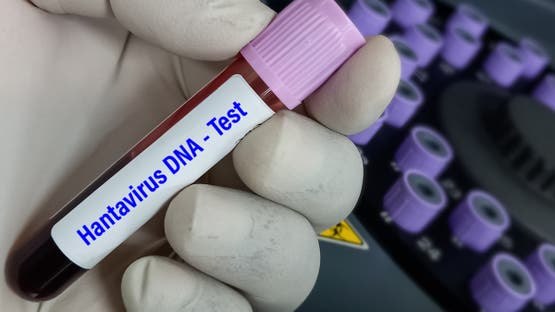 تفشٍ فيروس خطير على سفينة سياحية بريطانية